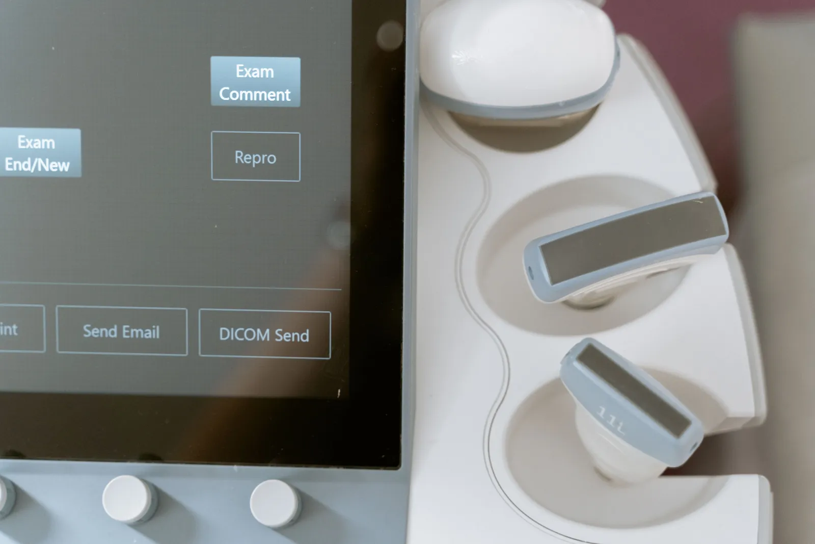 Close-up image of ultrasound equipment showing the monitor and probe holders